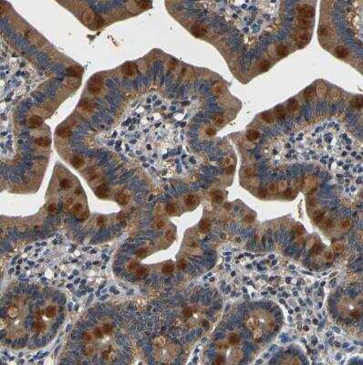 Immunohistochemistry-Paraffin TNIK Antibody