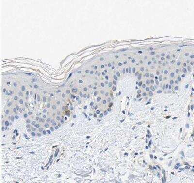 Immunohistochemistry-Paraffin TNIK Antibody