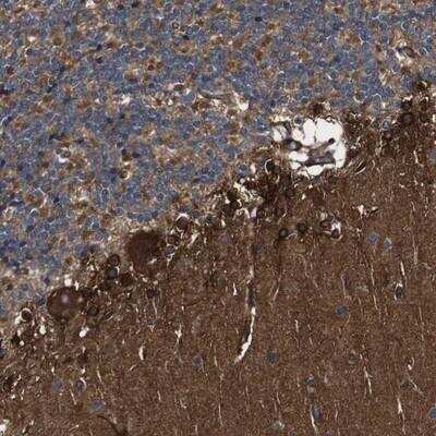 Immunohistochemistry-Paraffin: TNIK Antibody [NBP1-82995] - Staining of human cerebellum shows strong cytoplasmic positivity in purkinje cells.