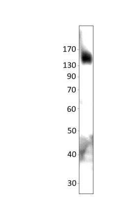 Western Blot: TNIK Antibody [NBP3-12424] - HER18 cells. Apparent MW is 155 KDa. 1:750 antibody dilution in Dilobuffer.