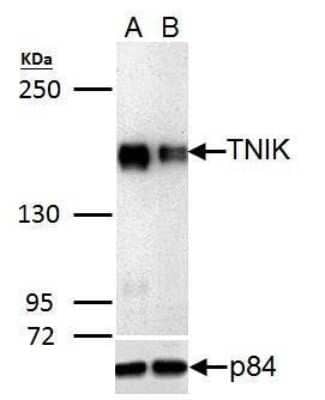 Western Blot: TNIK Antibody [NBP3-13022] - TNIK antibody validation by shRNA knock-down Upper panel: TNIK antibody (NBP3-13022) Lower panel: p84 antibody(NB100-174) A. 30 ug 293T whole cell lysate/extract B. 30 ug whole cell lysate/extract of TNIK shRNA-transfected 293T cells 5% SDS-PAGE TNIK antibody (NBP3-13022) dilution: 1:5000 p84 antibody(NB100-174) dilution: 1:10000 The HRP-conjugated anti-rabbit IgG antibody (NBP2-19301) was used to detect the primary antibody.