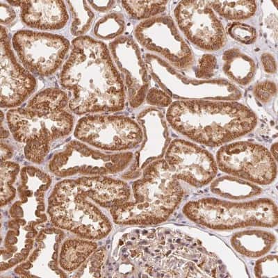 Immunohistochemistry-Paraffin: TNIP2 Antibody [NBP2-48949] - Staining of human kidney shows cytoplasmic positivity in renal tubules.
