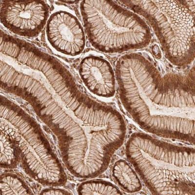 Immunohistochemistry-Paraffin: TNIP2 Antibody [NBP2-49389] - Staining of human stomach shows strong cytoplasmic, membranous and nuclear positivity in glandular cells.