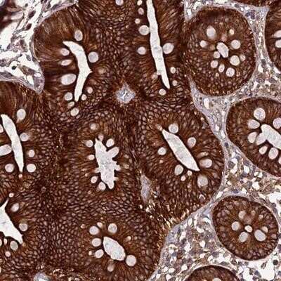 Immunohistochemistry-Paraffin: TNIP3 Antibody [NBP1-89305] - Staining of human colon shows strong cytoplasmic and membranous positivity in glandular cells.