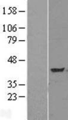 Western Blot: TNIP3 Overexpression Lysate (Adult Normal) [NBL1-17174] Left-Empty vector transfected control cell lysate (HEK293 cell lysate); Right -Over-expression Lysate for TNIP3.