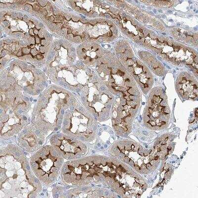 Immunohistochemistry-Paraffin TNN Antibody - BSA Free