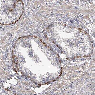 Immunohistochemistry-Paraffin: TNN Antibody [NBP1-91048] - Staining of human prostate shows moderate to strong cytoplasmic positivity in a subset of glandular cells.