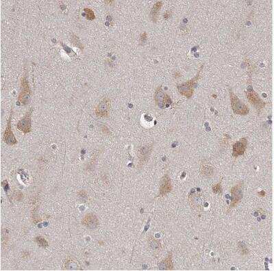 Immunohistochemistry-Paraffin: TNN Antibody [NBP1-91048] -  Staining of human cerebral cortex shows weak to moderate cytoplasmic positivity in neurons.