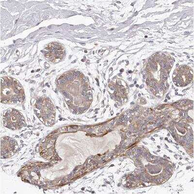 Immunohistochemistry-Paraffin TNN Antibody - BSA Free
