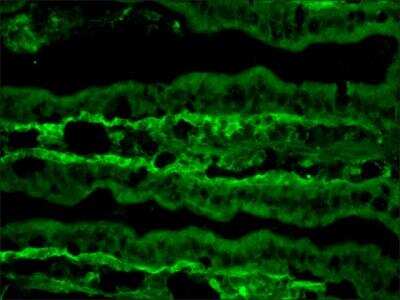 Immunohistochemistry-Frozen TNN Antibody (MTn-12)