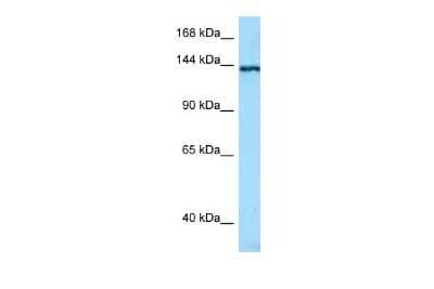 Western Blot: TNN Antibody [NBP2-85966] - WB Suggested Anti-TNN Antibody. Titration: 1.0 ug/ml. Positive Control: RPMI-8226 Whole CellTNN is supported by BioGPS gene expression data to be expressed in RPMI 8226