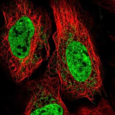 Immunocytochemistry/Immunofluorescence: TNNC2 Antibody [NBP2-49282] - Staining of human cell line U-2 OS shows localization to nucleoplasm & vesicles. Antibody staining is shown in green. 