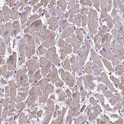 Immunohistochemistry-Paraffin TNNC2 Antibody - BSA Free