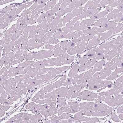 Immunohistochemistry-Paraffin: TNNC2 Antibody [NBP2-49282] - Staining of human heart muscle shows low expression as expected.