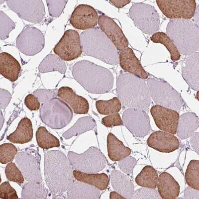 Immunohistochemistry-Paraffin: TNNC2 Antibody [NBP2-49282] - Staining of human skeletal muscle shows high expression.