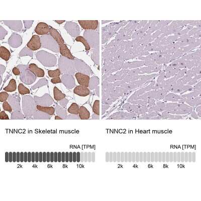 Immunohistochemistry-Paraffin: TNNC2 Antibody [NBP2-49282] - Staining in human skeletal muscle and heart muscle tissues using anti-TNNC2 antibody. Corresponding TNNC2 RNA-seq data are presented for the same tissues.