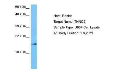 Western Blot: TNNC2 Antibody [NBP2-85968] - Host: Rabbit. Target Name: TNNC2. Sample Tissue: Human U937 Whole Cell lysates. Antibody Dilution: 1ug/ml