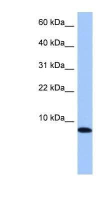 Western Blot: TNP1 Antibody [NBP1-55356] - 721_B cell lysate, concentration 0.2-1 ug/ml.