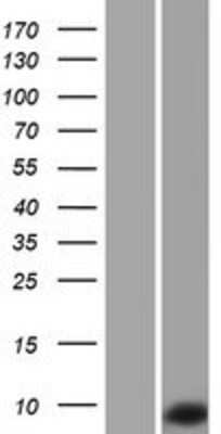 Western Blot: TNP1 Overexpression Lysate (Adult Normal) [NBP2-08023] Left-Empty vector transfected control cell lysate (HEK293 cell lysate); Right -Over-expression Lysate for TNP1.