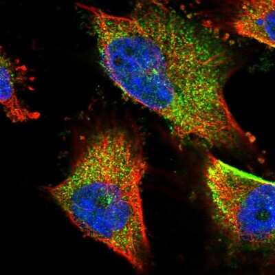 Immunocytochemistry/Immunofluorescence: TNPO3 Antibody [NBP2-58965] - Staining of human cell line U-251 MG shows localization to vesicles. Antibody staining is shown in green.