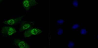 Immunocytochemistry/Immunofluorescence: TNPO3 Antibody (JG38-77) [NBP2-75685] - Staining TNPO3 in A549 cells (green). The nuclear counter stain is DAPI (blue). Cells were fixed in paraformaldehyde, permeabilised with 0.25% Triton X100/PBS.