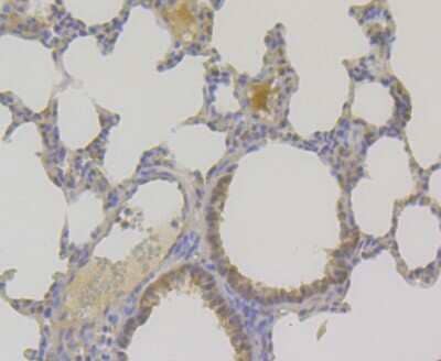 Immunohistochemistry-Paraffin: TNPO3 Antibody (JG38-77) [NBP2-75685] - Analysis of paraffin-embedded mouse lung tissue using anti-TNPO3 antibody. Counter stained with hematoxylin.