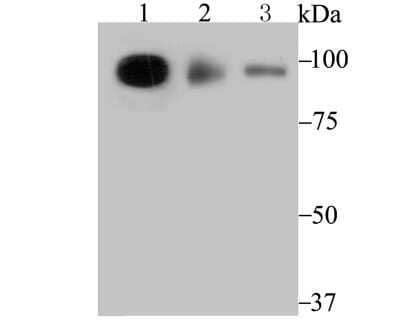 Western Blot: TNPO3 Antibody (JG38-77) [NBP2-75685] - Analysis of TNPO3 on K562 cell (1), HL-60 cell (2) and mouse pancreas tissue (3) lysate using anti-TNPO3 antibody at 1/1,000 dilution.