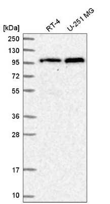Western Blot: TNPO3 Antibody [NBP2-58965] - Analysis in human cell line RT-4 and human cell line U-251 MG.