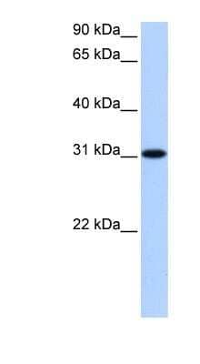 Western Blot: TNRC18B Antibody [NBP1-91426] - 721_B cell lysate, concentration 0.2-1 ug/ml.