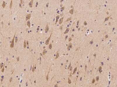 Immunohistochemistry-Paraffin: TNRC6B Antibody [NBP2-98079] - Immunochemical staining of human TNRC6B in human brain with rabbit polyclonal antibody at 1:100 dilution, formalin-fixed paraffin embedded sections.