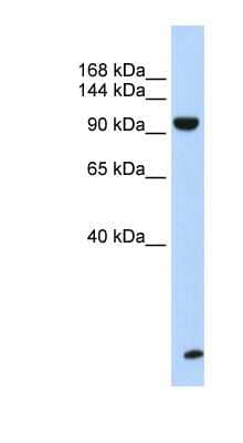 Western Blot: TNRC6B Antibody [NBP1-57461] - Human Muscle lysate, concentration 0.2-1 ug/ml.