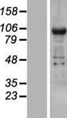 Western Blot TNRC6B Overexpression Lysate