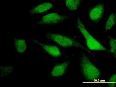 Immunocytochemistry/Immunofluorescence: TNRC6C Antibody (3G11) [H00057690-M08] - Analysis of monoclonal antibody to TNRC6C on HeLa cell. Antibody concentration 10 ug/ml