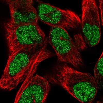 Immunocytochemistry/Immunofluorescence: TNRC6C Antibody [NBP2-56257] - Staining of human cell line RH-30 shows localization to nucleus.