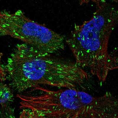 Immunocytochemistry/Immunofluorescence: TNS3 Antibody [NBP2-37948] - Staining of human cell line U-251 MG shows localization to focal adhesion sites. Antibody staining is shown in green.