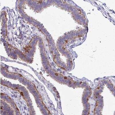 Immunohistochemistry-Paraffin: TNS3 Antibody [NBP2-37948] - Staining of human fallopian tube shows moderate to strong cytoplasmic positivity in glandular cells.