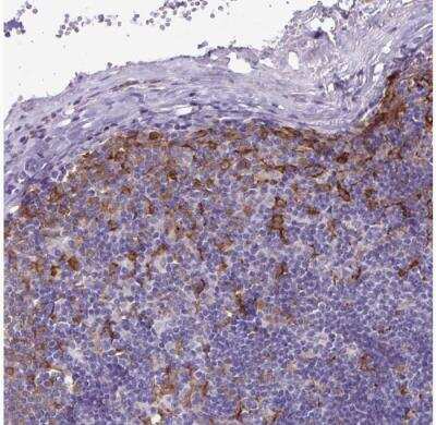 Immunohistochemistry-Paraffin: TNS3 Antibody [NBP2-37948] - Staining of human lymph node shows moderate to strong cytoplasmic positivity in macrophages.