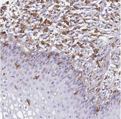 Immunohistochemistry-Paraffin: TNS3 Antibody [NBP2-37948] - Staining of human cervix, uterine shows moderate to strong cytoplasmic positivity in macrophages.