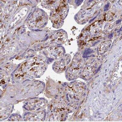 Immunohistochemistry-Paraffin: TNS3 Antibody [NBP2-37948] - Staining of human placenta shows moderate to strong cytoplasmic positivity in Hofbauer cells.