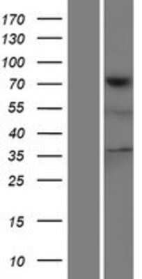 Western Blot: TNS4 Overexpression Lysate (Adult Normal) [NBP2-05961] Left-Empty vector transfected control cell lysate (HEK293 cell lysate); Right -Over-expression Lysate for TNS4.
