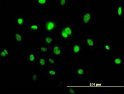 Immunocytochemistry/Immunofluorescence: TOB1 Antibody [H00010140-B01P] - Analysis of purified antibody to TOB1 on HeLa cell. (antibody concentration 10 ug/ml)