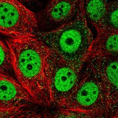 Immunocytochemistry/ Immunofluorescence TOB1 Antibody