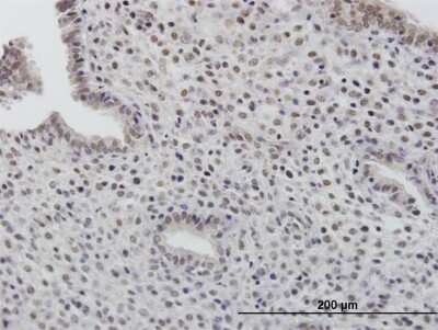 Immunohistochemistry-Paraffin: TOB1 Antibody [H00010140-B01P] - Analysis of purified antibody to TOB1 on formalin-fixed paraffin-embedded human endometrium. (antibody concentration 3 ug/ml)