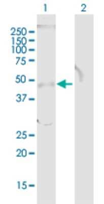 Western Blot TOB1 Antibody