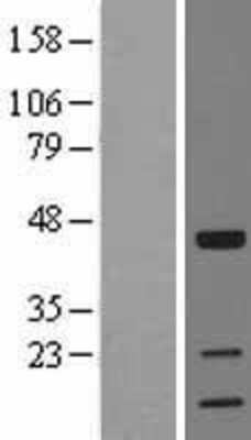 Western Blot: TOB1 Overexpression Lysate (Adult Normal) [NBL1-17185] Left-Empty vector transfected control cell lysate (HEK293 cell lysate); Right -Over-expression Lysate for TOB1.