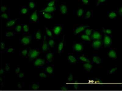 Immunocytochemistry/Immunofluorescence: TOE1 Antibody (1D4) [H00114034-M03] - Analysis of monoclonal antibody to TOE1 on HeLa cell. Antibody concentration 25 ug/ml