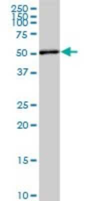 Western Blot: TOE1 Antibody (1D4) [H00114034-M03] - Analysis of TOE1 expression in human pancreas.