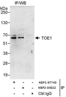 Immunoprecipitation: TOE1 Antibody [NBP2-04022] - Samples: Whole cell lysate (1 mg for IP, 20% of IP loaded) from HeLa cells. Antibodies: Affinity purified rabbit anti-TOE1 antibody used for IP at 6 ug/mg lysate. TOE1 was also immunoprecipitated by rabbit anti-TOE1 antibody , which recognizes a downstream epitope. For blotting immunoprecipitated TOE1, was used at 1 ug/ml. Detection: Chemiluminescence with an exposure time of 30 seconds.