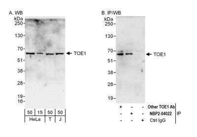 <b>Independent Antibodies Validation. </b>Immunoprecipitation: TOE1 Antibody [NBP2-04022] - Detection of human TOE1 by western blot and immunoprecipitation. Samples: Whole cell lysate from HeLa (15 and 50 ug for WB; 1 mg for IP, 20% of IP loaded), HEK293T (T; 50 ug) and Jurkat (J; 50 ug) cells. Antibodies: Affinity purified rabbit anti-TOE1 antibody NBP2-04022 used for WB at 0.4 ug/ml (A) and 1 ug/ml (B) and used for IP at 6 ug/mg lysate. TOE1 was also immunoprecipitated by another rabbit anti-TOE1 antibody, which recognizes an upstream epitope. Detection: Chemiluminescence with exposure times of 3 minutes (A) and 30 seconds (B).