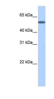 Western Blot: TOE1 Antibody [NBP1-53158] - Human Brain lysate, concentration 0.2-1 ug/ml.